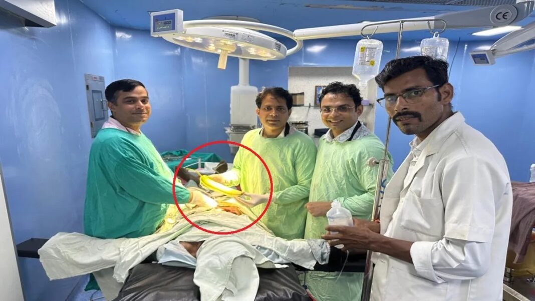 In Chhatarpur doctors remove 16-inch bottle gourd from man’s rectum