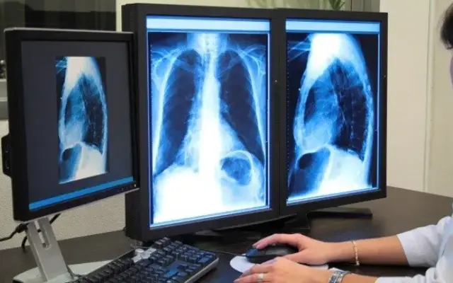 Radiologist and hospital held negligent for false scan report